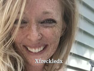 Xfreckledx